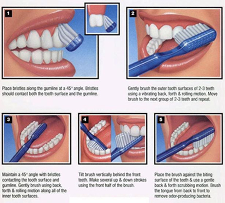 101_b How to Brush