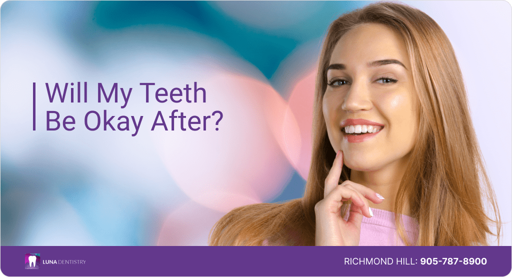 Cosmetic Dentistry Options for Crooked Teeth 1-min