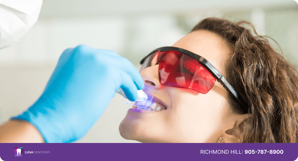 office Cosmetic Teeth Bleaching