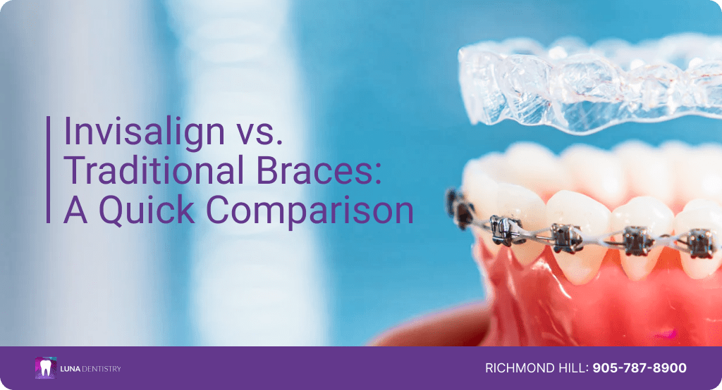 invisalign vs braces cost