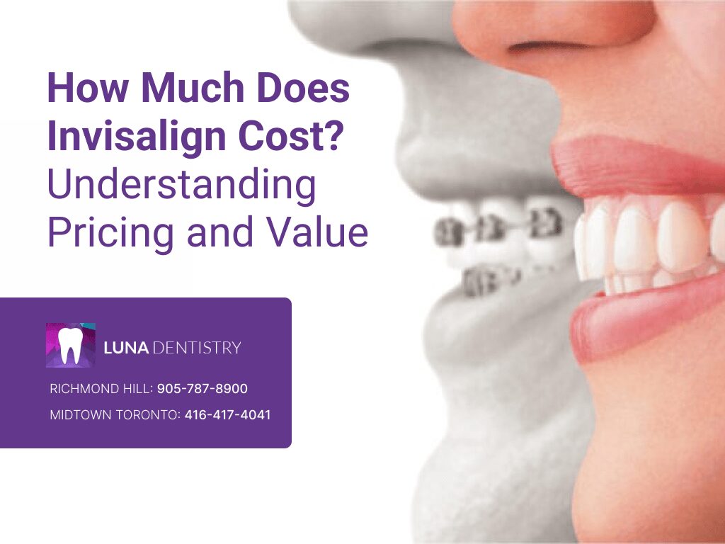 how much does Invisalign cost how much does Invisalign cost